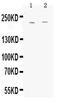 ATP Binding Cassette Subfamily C Member 1 antibody, A00872, Boster Biological Technology, Western Blot image 