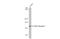 Fms Related Tyrosine Kinase 1 antibody, GTX128969, GeneTex, Western Blot image 