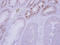 Glucokinase Regulator antibody, LS-C155498, Lifespan Biosciences, Immunohistochemistry frozen image 
