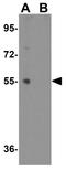 Glycoprotein VI Platelet antibody, GTX31359, GeneTex, Western Blot image 