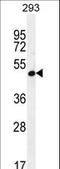 Alpha 1,4-Galactosyltransferase (P Blood Group) antibody, LS-C155824, Lifespan Biosciences, Western Blot image 