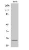 SUMO Peptidase Family Member, NEDD8 Specific antibody, STJ95607, St John