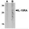 Interleukin 15 Receptor Subunit Alpha antibody, MBS153635, MyBioSource, Western Blot image 