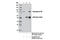 Semaphorin-3B antibody, 13299S, Cell Signaling Technology, Immunoprecipitation image 