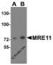 MRE11 Homolog, Double Strand Break Repair Nuclease antibody, 5547, ProSci, Western Blot image 