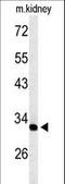 Transmembrane And Ubiquitin Like Domain Containing 2 antibody, LS-C162050, Lifespan Biosciences, Western Blot image 