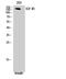 Insulin Like Growth Factor 1 Receptor antibody, STJ93648, St John