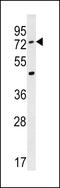 Acyl-CoA Synthetase Medium Chain Family Member 2A antibody, 60-110, ProSci, Western Blot image 