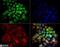Telomerase Reverse Transcriptase antibody, NB110-89471, Novus Biologicals, Immunocytochemistry image 