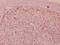 Fms Related Tyrosine Kinase 3 antibody, A00188Y591, Boster Biological Technology, Immunohistochemistry paraffin image 