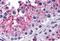 Karyopherin Subunit Alpha 5 antibody, A09441, Boster Biological Technology, Immunohistochemistry paraffin image 