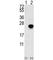 Fibroblast Growth Factor 1 antibody, F49618-0.4ML, NSJ Bioreagents, Western Blot image 