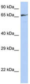 Zinc Finger Protein 676 antibody, TA342106, Origene, Western Blot image 