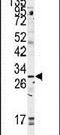 Golgi Phosphoprotein 3 antibody, PA5-14348, Invitrogen Antibodies, Western Blot image 