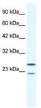 Tripartite motif-containing protein 14 antibody, TA338078, Origene, Western Blot image 