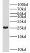 Transmembrane P24 Trafficking Protein 4 antibody, FNab08740, FineTest, Western Blot image 