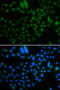 AlkB Homolog 8, TRNA Methyltransferase antibody, 22-736, ProSci, Immunofluorescence image 