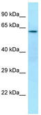 CDK5 Regulatory Subunit Associated Protein 3 antibody, TA343181, Origene, Western Blot image 