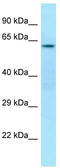 CDK5 Regulatory Subunit Associated Protein 3 antibody, TA343181, Origene, Western Blot image 