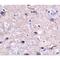 Programmed Cell Death 1 antibody, NBP1-75519, Novus Biologicals, Immunohistochemistry paraffin image 