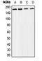 SWI/SNF Related, Matrix Associated, Actin Dependent Regulator Of Chromatin Subfamily C Member 2 antibody, LS-C354078, Lifespan Biosciences, Western Blot image 