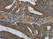 Phosphoenolpyruvate Carboxykinase 2, Mitochondrial antibody, CSB-PA253485, Cusabio, Immunohistochemistry paraffin image 