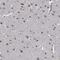 Cytoplasmic tRNA 2-thiolation protein 2 antibody, PA5-59441, Invitrogen Antibodies, Immunohistochemistry paraffin image 