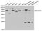 TGF-Beta Activated Kinase 1 (MAP3K7) Binding Protein 1 antibody, TA332884, Origene, Western Blot image 