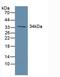 Growth Hormone Receptor antibody, LS-C294363, Lifespan Biosciences, Western Blot image 