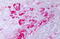 Crystallin Alpha B antibody, MBS245549, MyBioSource, Immunohistochemistry paraffin image 