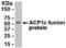 Acid Phosphatase 1 antibody, XW-7855, ProSci, Western Blot image 
