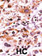 Fibroblast Growth Factor Receptor 1 antibody, abx031862, Abbexa, Immunohistochemistry paraffin image 