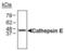 Cathepsin E antibody, PA3-16821, Invitrogen Antibodies, Western Blot image 