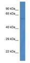 Protein Phosphatase 3 Catalytic Subunit Beta antibody, NBP1-74253, Novus Biologicals, Western Blot image 