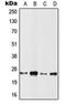 RAS Related 2 antibody, orb215056, Biorbyt, Western Blot image 