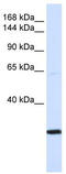 Structural Maintenance Of Chromosomes 2 antibody, TA338985, Origene, Western Blot image 