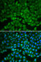 Glutathione Synthetase antibody, 15-022, ProSci, Immunofluorescence image 