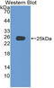 Adenylate Cyclase 4 antibody, LS-C314775, Lifespan Biosciences, Western Blot image 