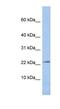 Junctional Adhesion Molecule 3 antibody, NBP1-60096, Novus Biologicals, Western Blot image 