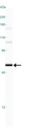 Corticotropin Releasing Hormone Receptor 2 antibody, NB100-56485, Novus Biologicals, Western Blot image 