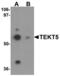 Tektin-5 antibody, LS-B9521, Lifespan Biosciences, Western Blot image 