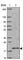 Adaptor Related Protein Complex 1 Subunit Sigma 1 antibody, HPA060945, Atlas Antibodies, Western Blot image 