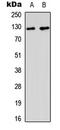 MutS Homolog 3 antibody, abx121527, Abbexa, Western Blot image 