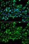 Carbonyl Reductase 3 antibody, GTX64745, GeneTex, Immunocytochemistry image 