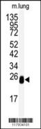 L-xylulose reductase antibody, 62-913, ProSci, Western Blot image 