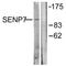 SUMO Specific Peptidase 7 antibody, A08121, Boster Biological Technology, Western Blot image 