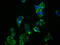 Protein Kinase CAMP-Dependent Type I Regulatory Subunit Alpha antibody, CSB-RA018694A0HU, Cusabio, Immunofluorescence image 