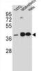 Estrogen Receptor 2 antibody, abx031112, Abbexa, Western Blot image 