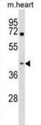 KH RNA Binding Domain Containing, Signal Transduction Associated 1 antibody, abx030956, Abbexa, Western Blot image 