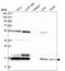 Ubiquitin Conjugating Enzyme E2 C antibody, HPA034569, Atlas Antibodies, Western Blot image 